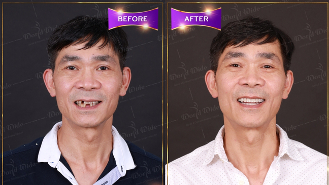 Slider image (2) Worldwide Dental & Cosmetic Surgery Hospital